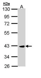 Anti-CKII alpha antibody [N1C3] used in Western Blot (WB). GTX110726