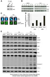 Anti-Hec1 antibody used in Western Blot (WB). GTX110735