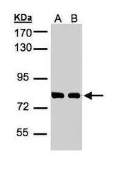 Anti-Hec1 antibody used in Western Blot (WB). GTX110735