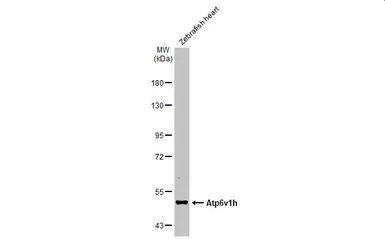 Anti-ATP6V1H antibody [N3C3] used in Western Blot (WB). GTX110778