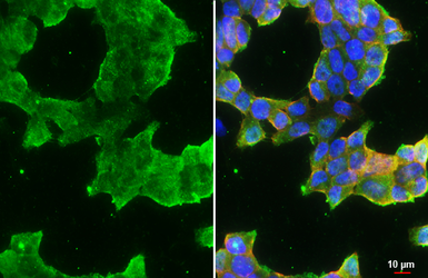 Anti-ATP6V1H antibody [N3C3] used in Immunocytochemistry/ Immunofluorescence (ICC/IF). GTX110778