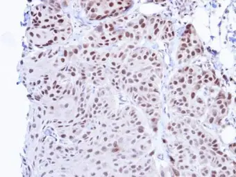 Anti-TBLR1 antibody [N3C3] used in IHC (Paraffin sections) (IHC-P). GTX110785