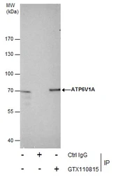Anti-ATP6V1A antibody used in Immunoprecipitation (IP). GTX110815