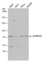 Anti-ATP6V1A antibody used in Western Blot (WB). GTX110815
