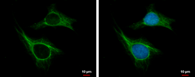 Anti-CKAP2 antibody used in Immunocytochemistry/ Immunofluorescence (ICC/IF). GTX110830