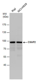 Anti-CKAP2 antibody used in Western Blot (WB). GTX110830