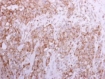 Anti-Sortilin 1 antibody [C1C3] used in IHC (Paraffin sections) (IHC-P). GTX110857