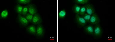 Anti-CCAR1 antibody used in Immunocytochemistry/ Immunofluorescence (ICC/IF). GTX110892