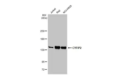 Anti-CYFIP2 antibody [N2C1], Internal used in Western Blot (WB). GTX110897