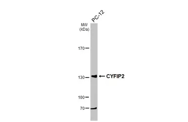 Anti-CYFIP2 antibody [N2C1], Internal used in Western Blot (WB). GTX110897
