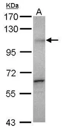 Anti-Gemin 3 antibody [N3C2], Internal used in Western Blot (WB). GTX110962