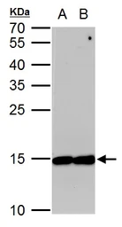 Anti-EIF5A antibody used in Western Blot (WB). GTX111013