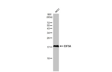 Anti-EIF5A antibody used in Western Blot (WB). GTX111013