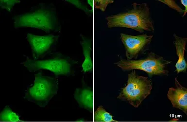 Anti-EIF5A antibody used in Immunocytochemistry/ Immunofluorescence (ICC/IF). GTX111013