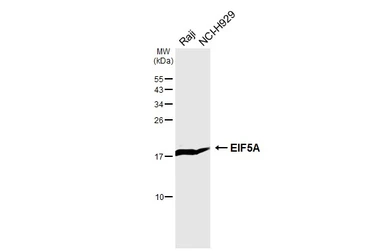Anti-EIF5A antibody used in Western Blot (WB). GTX111013
