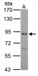 Anti-RSK2 antibody used in Western Blot (WB). GTX111049