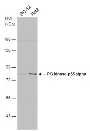 Anti-PI3 kinase p85 alpha antibody [N2C1], Internal used in Western Blot (WB). GTX111068