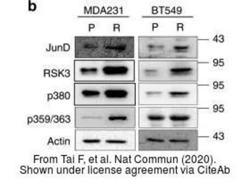 Anti-RSK3 antibody [N2C1], Internal used in Western Blot (WB). GTX111071