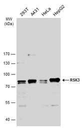 Anti-RSK3 antibody [N2C1], Internal used in Western Blot (WB). GTX111071