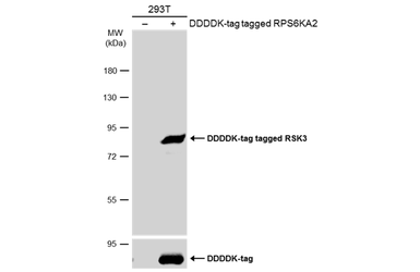 Anti-RSK3 antibody [N2C1], Internal used in Western Blot (WB). GTX111071