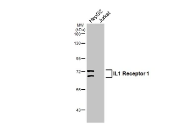 Anti-IL1 Receptor 1 antibody [C1C3] used in Western Blot (WB). GTX111092