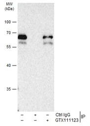 Anti-SMAD2 / SMAD3 antibody used in Immunoprecipitation (IP). GTX111123