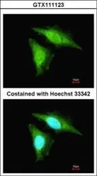Anti-SMAD2 / SMAD3 antibody used in Immunocytochemistry/ Immunofluorescence (ICC/IF). GTX111123
