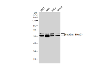Anti-SMAD2 / SMAD3 antibody used in Western Blot (WB). GTX111123