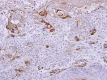 Anti-HIPPI antibody [N1C3] used in IHC (Paraffin sections) (IHC-P). GTX111124