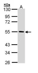 Anti-HIPPI antibody [N1C3] used in Western Blot (WB). GTX111124