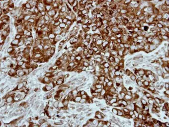 Anti-PPP3CB antibody [N1N3] used in IHC (Paraffin sections) (IHC-P). GTX111141