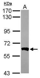 Anti-PPP3CB antibody [N1N3] used in Western Blot (WB). GTX111141