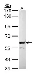 Anti-PPP3CB antibody [N1N3] used in Western Blot (WB). GTX111141