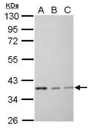 Anti-EEF1D antibody used in Western Blot (WB). GTX111151