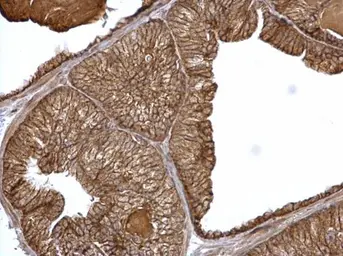 Anti-alpha Catenin antibody [N1N3] used in IHC (Paraffin sections) (IHC-P). GTX111168