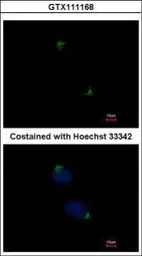 Anti-alpha Catenin antibody [N1N3] used in Immunocytochemistry/ Immunofluorescence (ICC/IF). GTX111168