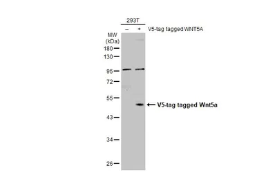 Anti-Wnt5a antibody used in Western Blot (WB). GTX111187
