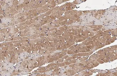 Anti-Wnt5a antibody used in IHC (Paraffin sections) (IHC-P). GTX111187
