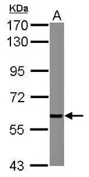 Anti-XIAP antibody used in Western Blot (WB). GTX111202