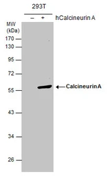 Anti-Calcineurin A antibody used in Western Blot (WB). GTX111207