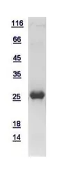 Human PHD3 protein, His tag. GTX111217-pro