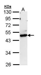 Anti-CtBP1 antibody [N1C1] used in Western Blot (WB). GTX111246