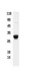 Human APIP protein, His tag. GTX111264-pro