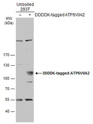 Anti-ATP6V0A2 antibody [N1N3] used in Western Blot (WB). GTX111275