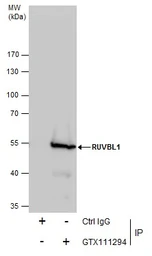 Anti-RUVBL1 antibody used in Immunoprecipitation (IP). GTX111294