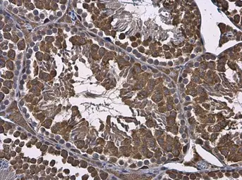 Anti-RUVBL1 antibody used in IHC (Paraffin sections) (IHC-P). GTX111294