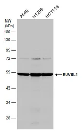 Anti-RUVBL1 antibody used in Western Blot (WB). GTX111294