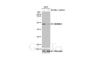 Anti-RUVBL1 antibody used in Western Blot (WB). GTX111294
