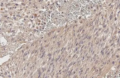 Anti-ADAM10 antibody [N1N2], N-term used in IHC (Paraffin sections) (IHC-P). GTX111347
