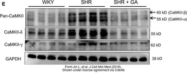 Anti-CaMKII delta antibody used in Western Blot (WB). GTX111401